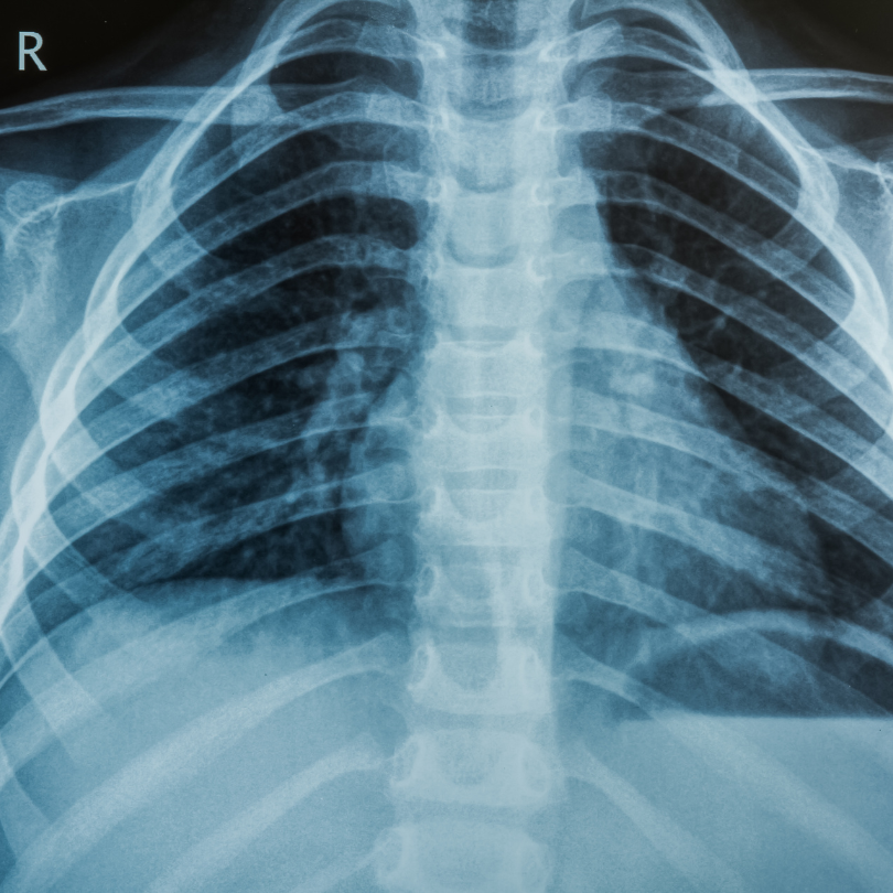 Radiology/X-Ray