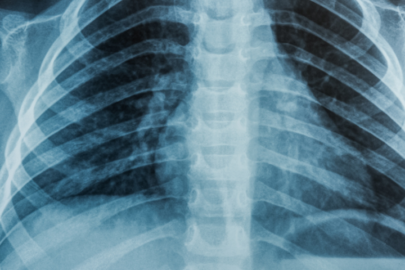 Radiology/X-Ray